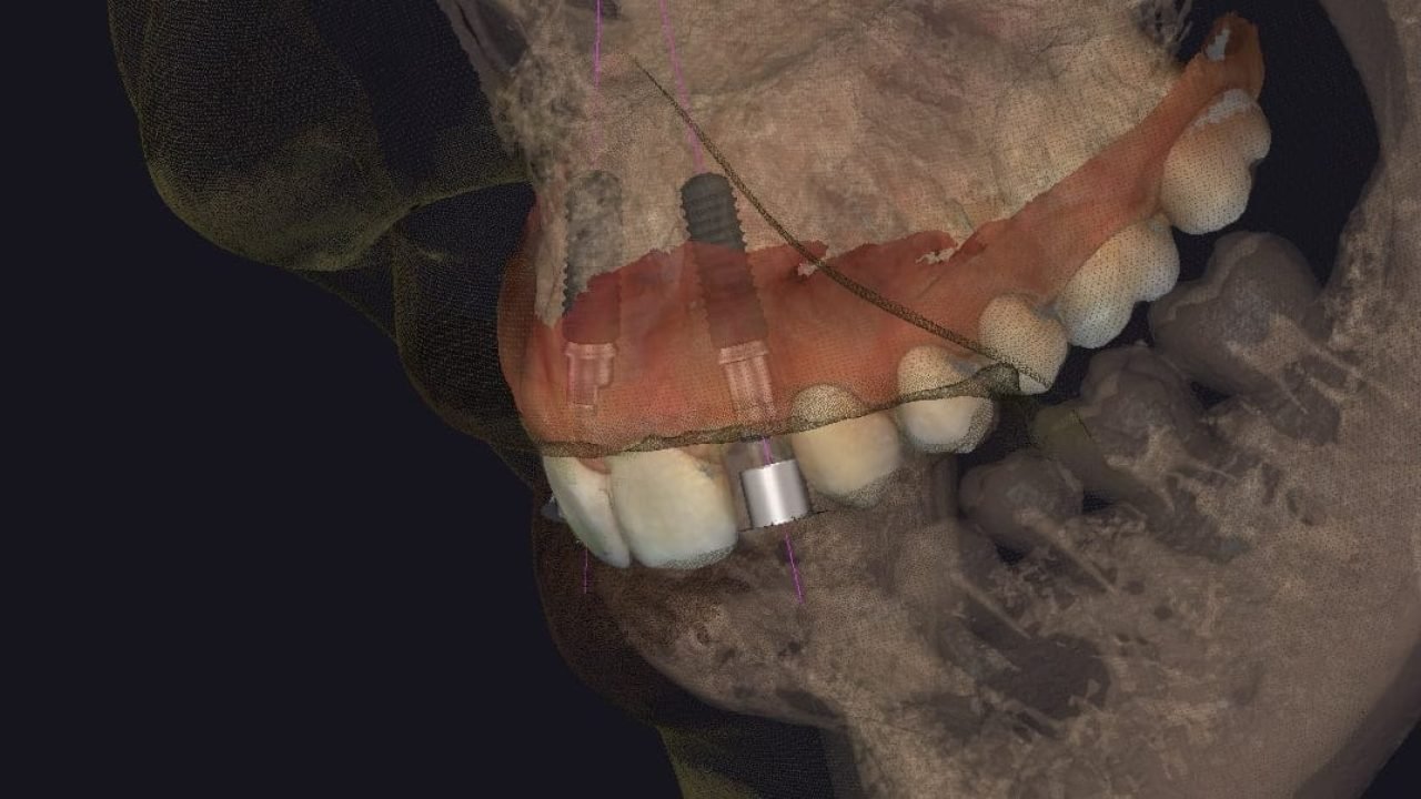 experto-exocad (5)