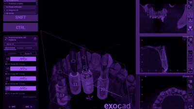 experto-exocad-exoplan