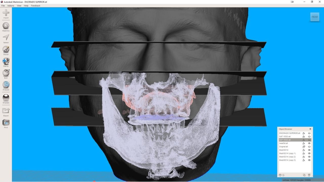 meshmixerdental_gallery (11)