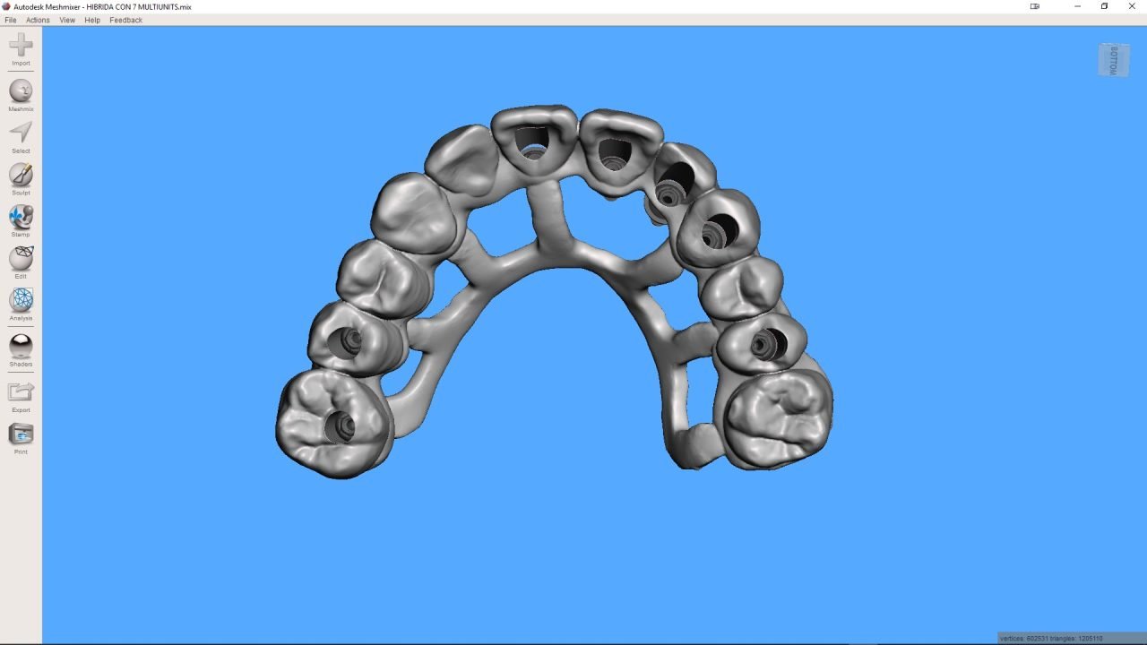 meshmixerdental_gallery (14)