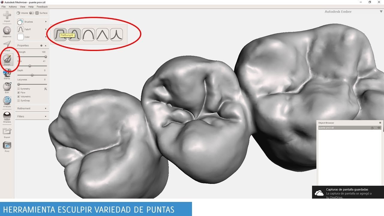 meshmixerdental_gallery (16)