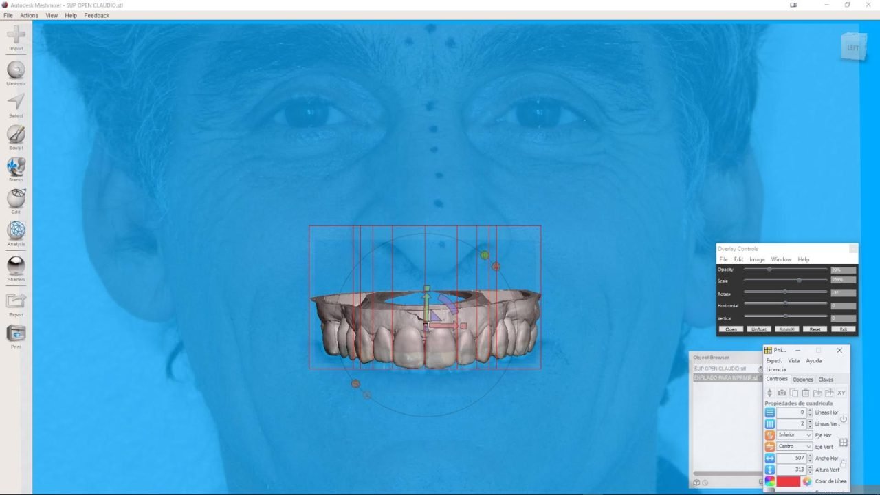 meshmixerdental_gallery (2)