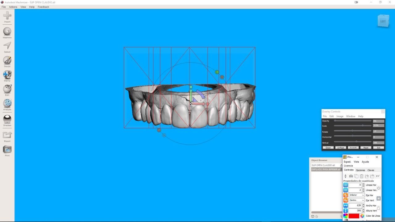 meshmixerdental_gallery (3)