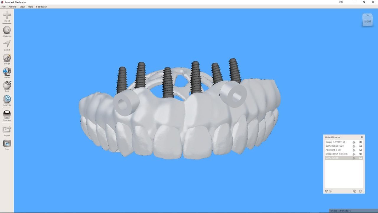 meshmixerdental_gallery (4)
