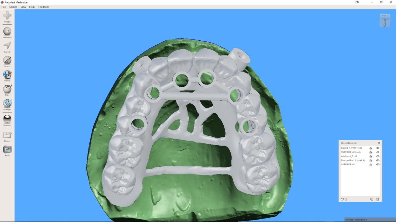 meshmixerdental_gallery (5)