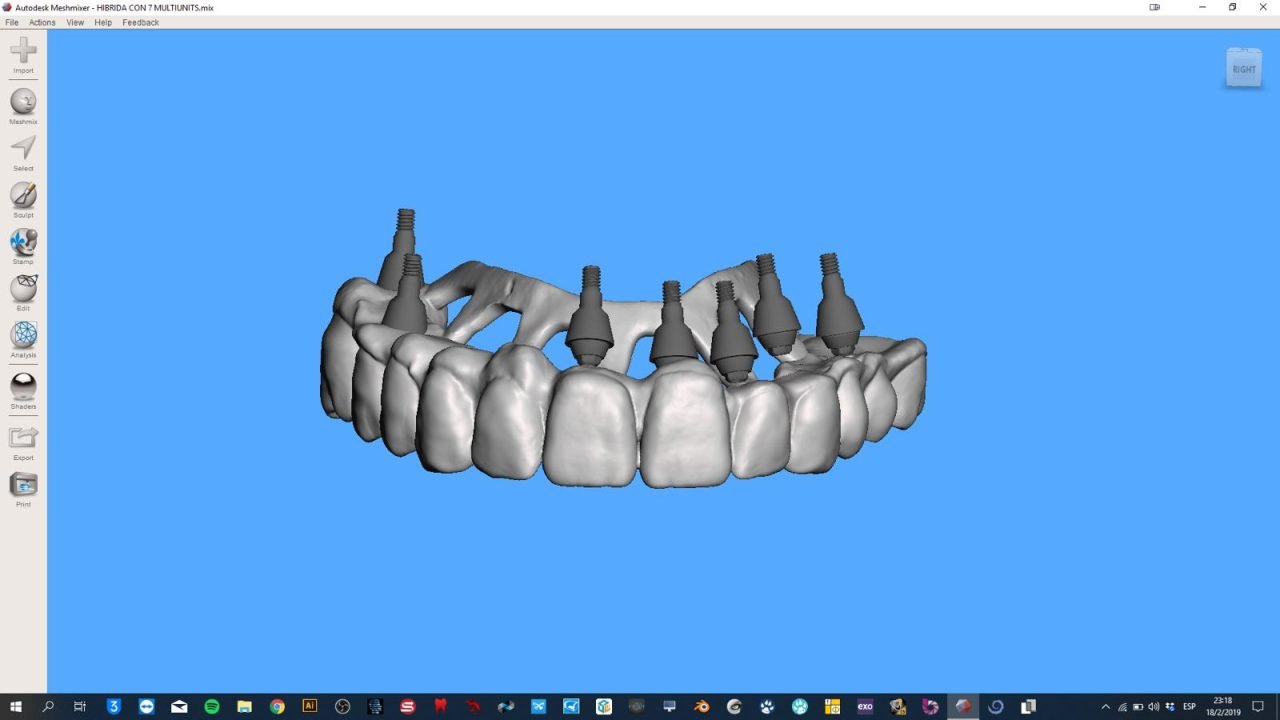 meshmixerdental_gallery (7)
