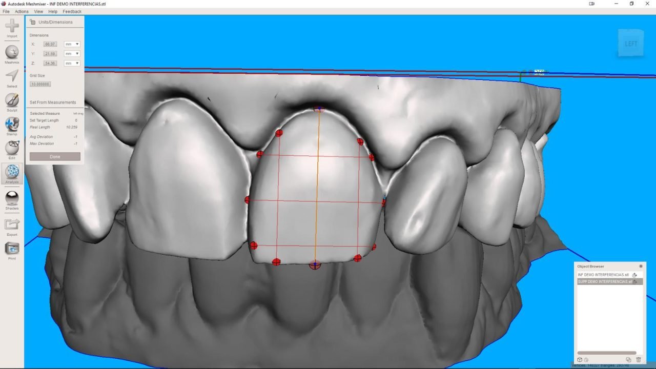 meshmixerdental_gallery (9)